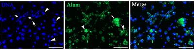 Vaccine Adjuvants Induce Formation of Intraperitoneal Extracellular Traps in Flounder (Paralichthys olivaceus)